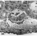 23 Embryo, chorionic cavity and surrounding trophoblast