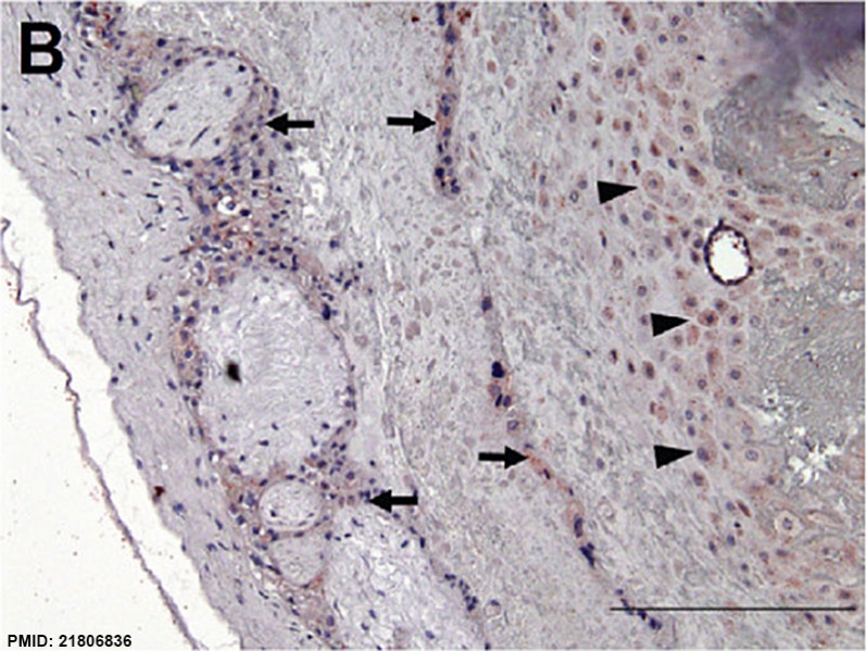 File:Human placenta SERPINE2 expression 01.jpg