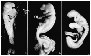 17 to 23 somite human embryos
