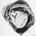 Fig. 227. A similar specimen with markedly flexed head. No. 1525. X0.66.
