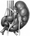 Horseshoe kidneys with asymmetric halves.