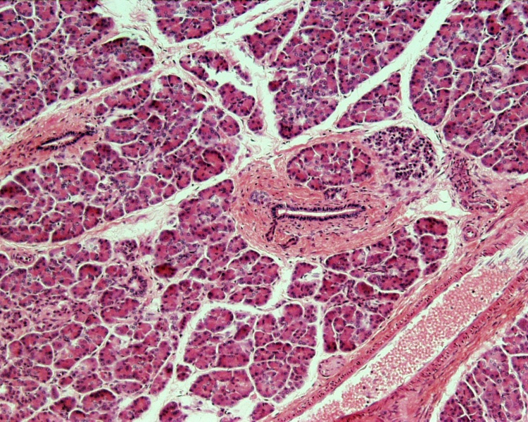 File:Pancreas histology 101.jpg