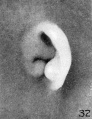 Fig. 32. Embryo No. 2075, 40 mm. (R.)