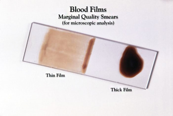 Blood Smear Slide