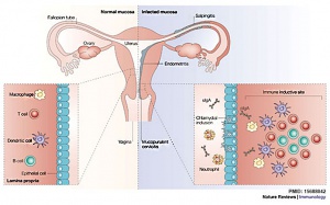 Female genital tract chlamydia trachomatis infection 01.jpg