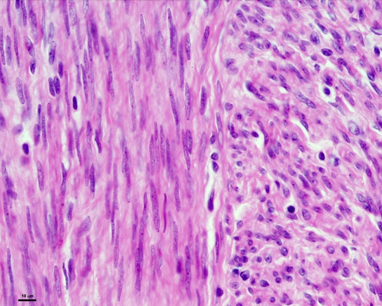File:Smooth muscle histology 009.jpg