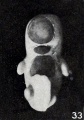 Fig. 33. Front view of same specimen, showing maceration and stunting. X3.
