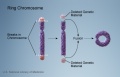 Chromosome - ring chromosome