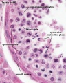 Adult Seminiferous tubule