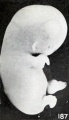 Fig. 187. Slight swelling of fetus from brief maceration. No. 2146. X2.