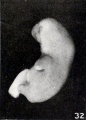 Fig. 32. Side view of cyema, showing so-called stunting. No. 2173. X3.
