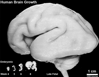 Human brain growth 01.jpg