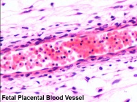 Placenta blood.jpg