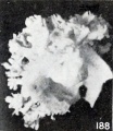 Fig. 188. Matted, slightly macerated villi. No. 1878. X4.