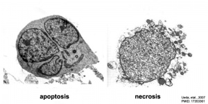 Apoptosis and necrosis.jpg
