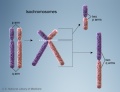 Chromosome - isochromosomes