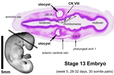 otic placode forms the otocyst