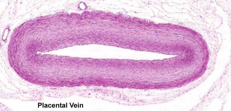 File:Placental vein.jpg