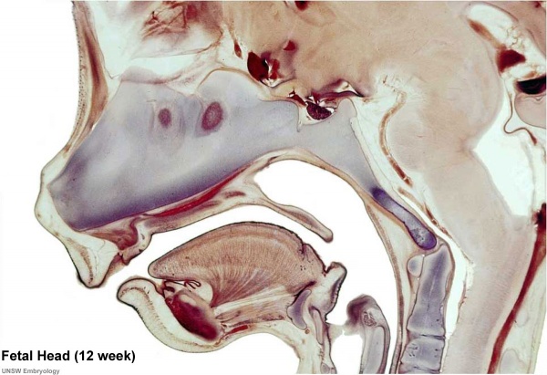 fetus at 12 weeks. Fetal Development - 12 Weeks -