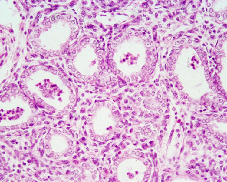 File:Fetal lung histology 01.jpg