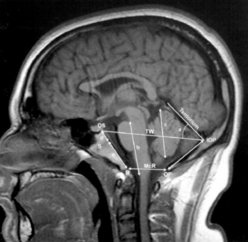 Human- adult brain MRI.jpg