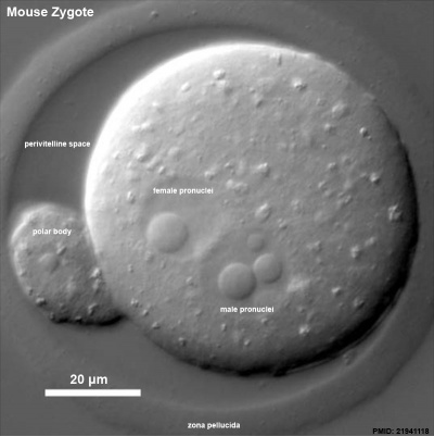 DIC image of early mouse zygote pronuclei