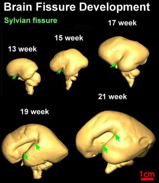 File:Brain fissure development 03.jpg