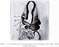 Fig. 3. Vertical Section through Head of Foetal Pig, 2 mm long