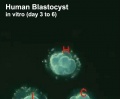Human-blastocyst-day-3-6-icon.jpg