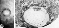 28-29 surface and mid-cross section 12-day ovum