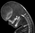 Fig 4 Embryo No. 284 Head