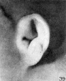 Fig. 39. Embryo No. 2079, 56.5 mm.