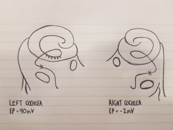 Left and Right Cochlea.jpeg