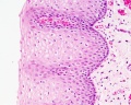 Oesophagus histology 01.jpg