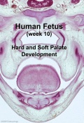 Fetal week 10 palate icon.jpg