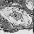 17 Embryo, chorionic cavity and adjacent trophoblast