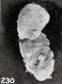 Fig. 230. A decidedly mummified fetus. No. 1295a. X0.77.