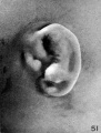 Fig. 51. Embryo No. 2185 113.5 mm