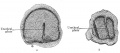 Fig. 653 a and b. Two sections through the clitoris of an embryo of 60 mm head-foot length. (Embryo R. Meyer 268; slide 66, row 2, section 1 and slide 67, row 1, section 2.) The urethral plate in section a extends from the anal surface of the clitoris only to the centre. In section 6, which passes through the tip, the clitoris is completely divided by the urethral plate.