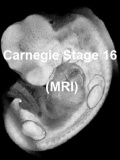 Stage16 MRI 3D01 icon.jpg