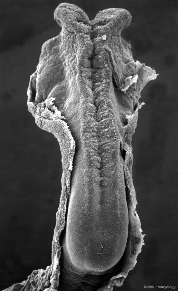 Human embryo stage 10 electron micrograph neural plate