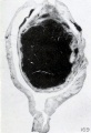 Fig. 169. Cross section of decidua and conceptus. No. 698. (See Chapter XII.) X4.5.