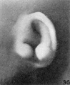 Fig. 36. Embryo No. 2095, 52 mm. (R.)