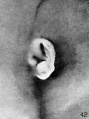 Fig. 42. Embryo No. 1724, 66.2 mm.