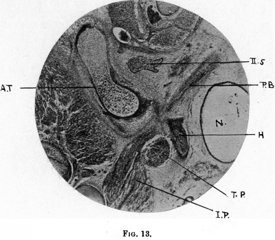 Fig. 13. 42 mm. embryo, shows ossification in the cartilage of the great wing