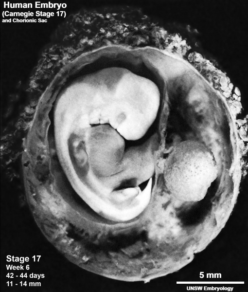 File:Stage17 embryo and membranes04.jpg