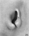Fig. 25. Embryo No. 1584 18 mm. long. X 24.