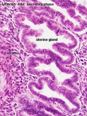 Uterine Gland Secretory Phase histology