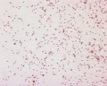 Human spermatozoa, x20, Papanicolaou stain