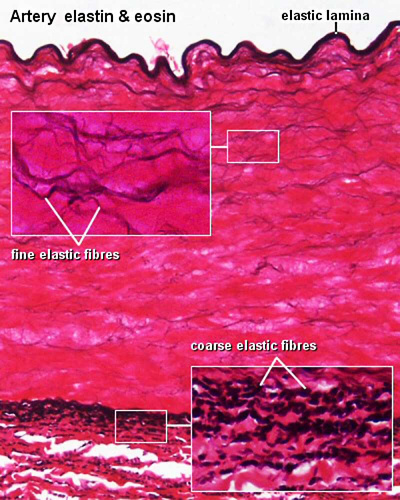 Artery histology 04.jpg